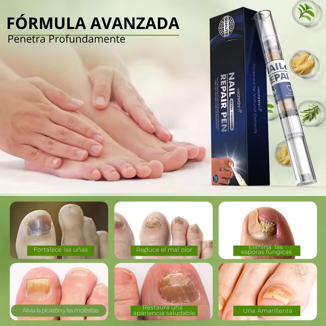 Lapiz antifuntico con formula Avanzada - Contra pie de Atleta y HONGOS en uñas