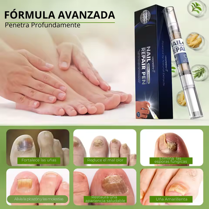 Lapiz antifuntico con formula Avanzada - Contra pie de Atleta y HONGOS en uñas
