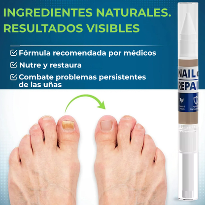 Lapiz antifuntico con formula Avanzada - Contra pie de Atleta y HONGOS en uñas
