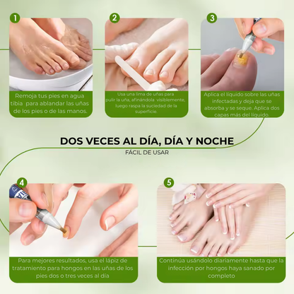 Lapiz antifuntico con formula Avanzada - Contra pie de Atleta y HONGOS en uñas